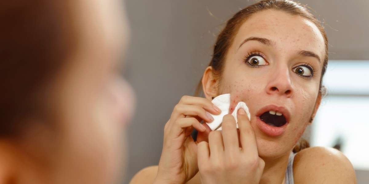 Probiotique peau : le secret naturel pour une peau éclatante et équilibrée